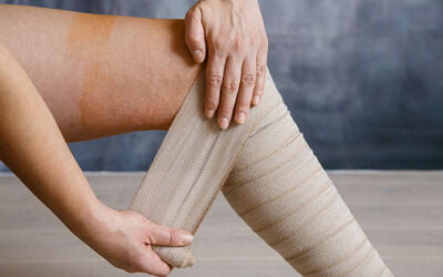 Side Effects Of Wearing Compression Stockings