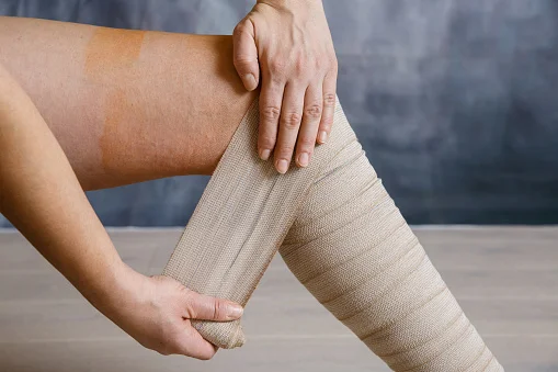What are the Side Effects of Wearing Compression Stockings?